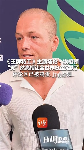 《王牌特工》主演塔伦·埃格顿 “秃”然亮相让全世界粉丝沉默了 其发际线后退、头顶发量堪忧 评论区已被鸡蛋.jpg占领