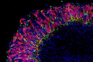 Stem cells—sorting the hype from the reality