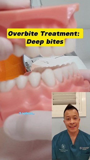 Perfecting Your Smile: 3 Overbite Correction Solutions!😁 #overbite #deepbite #dentallan #occlusion #dentalhealth #invisalign #braces #orthodontics