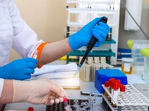 FBI: Beware Of Fake Coronavirus Antibody Tests