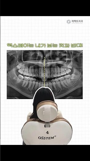 How to Read Dental X-rays, Explained by a Dentist!🤓