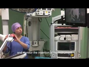 Robot Surgery - Xi Set Up