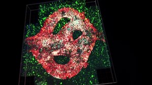 Patients’ 3D-printed tumors used in test treatments