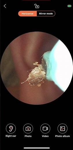How to Clean Ear Wax using Xiaomi Soulear Ear Wax Cleaner with Camera