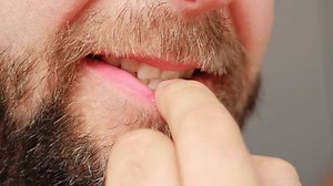 Stressed Adult Caucasian Male Biting Nails Stock Footage Video (100% Royalty-free) 1111124661 | Shutterstock