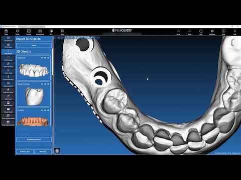 STL file processing and model set up with 3DIEMME RealGUIDE 5.0