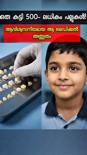 Shihad Shiu on Instagram: "​"526 പല്ലുകളുള്ള കുട്ടി! 🦷😱 അമ്പരപ്പിക്കുന്ന മെഡിക്കൽ അത്ഭുതം!" ​ഒരു കുട്ടിക്ക് 526 പല്ലുകളോ? 🦷 കേൾക്കുമ്പോൾ വിശ്വസിക്കാൻ പ്രയാസമായിരിക്കും, പക്ഷേ ഈ അപൂർവ്വ മെഡിക്കൽ അത്ഭുതം സംഭവിച്ചത് നമ്മുടെ ചെന്നൈയിലാണ്! 😱 ​താടിയെല്ലിലെ നീർക്കെട്ട് പരിശോധിച്ച ഡോക്ടർമാർ കണ്ടത് അമ്പരപ്പിക്കുന്ന കാഴ്ചയായിരുന്നു. ഒരു ചെറിയ സഞ്ചി പോലെ കണ്ട ഭാഗത്തിനുള്ളിൽ വിവിധ വലിപ്പത്തിലുള്ള 526 പല്ലുകൾ! ശസ്ത്രക്രിയയിലൂടെ ഇവ വിജയകരമായി നീക്കം ചെയ്തു. ✨ ​ഇതുപോലുള്ള വിസ്മയിപ്പിക്കുന്ന വീഡിയോകൾക്കായി 