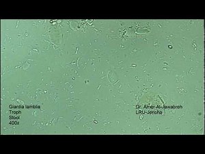 Giardia lamblia (intestinalis) trophozoite