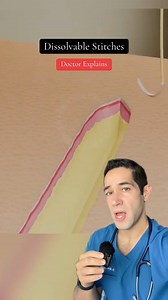 How dissolvable stitches work! #stitches #medical #doctorexplains #suture | Doctor Myro