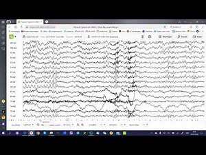 Online EEG viewer (web-based) - Neuron-Spectrum-WEB