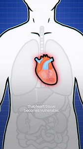 22K views · 156 reactions | Heartbreak and withdrawal aren't dissimilar. Losing that hit of oxytocin can leave our hearts vulnerable—literally. Learn more in What Does Love & Heartbreak Do To My Body?—the latest episode of #WhatDoesXDoToMyBody with Alzo Slade, now available on the Nat Geo YouTube channel: https://on.natgeo.com/4aQvLER | National Geographic TV | Facebook