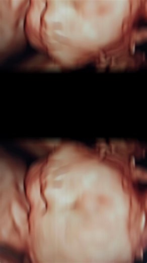 Celebrate the beginning of your baby’s story with their first picture at Stork Vision. #storkvisionbaytown | Stork Vision 3D 4D Ultrasound Baytown