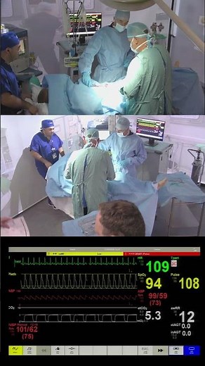 Cardiac Arrest in Theatre – Intraoperative Emergency Simulation