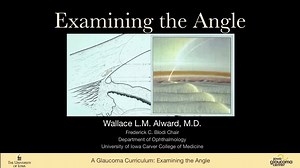 04 Examination of the angle. Gonioscopic techniques (UBM, AS-OCT) #The_University_of_Iowa_Glaucoma_Curriculum #Glaucoma http://curriculum.iowaglaucoma.org/ | Piece of ophthalmology