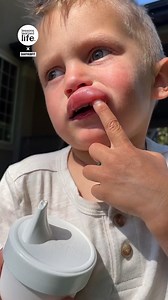 He took it like a champ! 🥹🐝 | Lessons Learned In Life