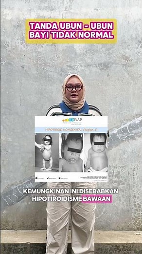 TANDA UBUN UBUN BAYI TIDAK NORMAL #tipsbayi #ubunubun #babygemesin