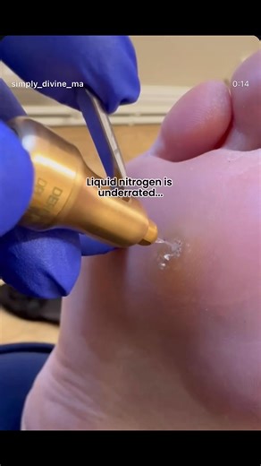 Nurse Debbie will be returning to the clinic on Friday 9th January, and she has limited availability on the day. Debbie offers the following treatments: • Skin tag removal • Verruca removal • Mole removal • Pigmentation and blemish removal • Milia removal Debbie is fully insured to treat children, where appropriate. | Gemini Aesthetics