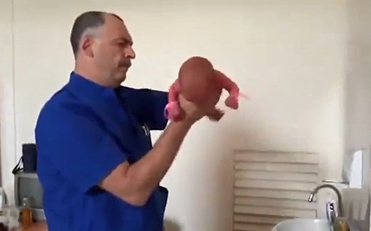 开眼界：俄罗斯医生检查刚出生的婴儿，这手法令人咋舌~