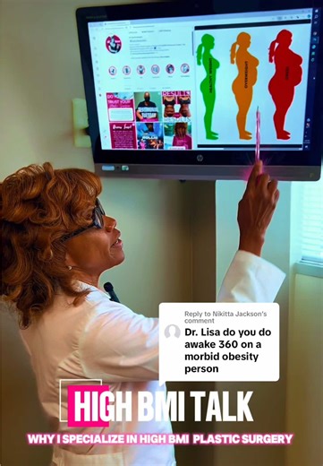 ✨ High BMI Liposuction: Tailored for Every Body✨Liposuction isn’t just for “one type” of body — it’s for real people with real goals. At Dr. Lissa Plastic Surgery, we specialize in awake liposuction for all sizes, including higher BMI patients. Ready to make your own dream look a reality? 💫✨ Drop us a DM us for more information and to set up your consultation - you can also text us at 404-240-2804…Let’s work together to achieve the results you’ve always wanted! #HighBMILipo #AwakeLipo #lipo360 