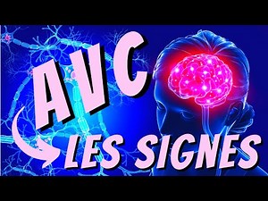 STROKE: DON'T MISS ANY SIGNS to ACT QUICKLY!