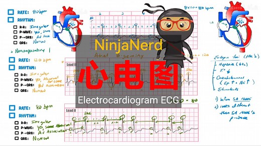 NinjaNerd系列【中英⚡心电图|Electrocardiogram ECG】