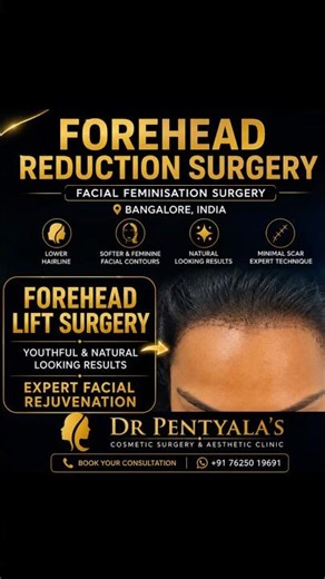 Forehead lift surgery by dr Pentyala’s #foreheadlift #ffsindia #facialfeminizationsurgery