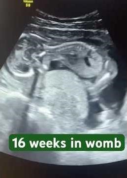 Can You See Baby 16 Weeks Movement?#baby #ultrasound