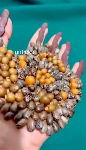 31217.#tripofobia #anciedade #satisfaction #stress #satisfatorio #skincare #fake #seeds #glue #parasite | Connor Lambert