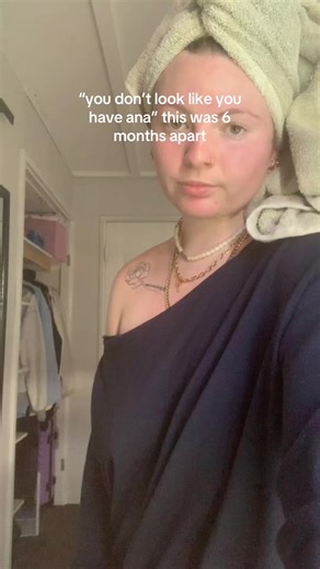 Understanding Anorexia Through a Personal Journey