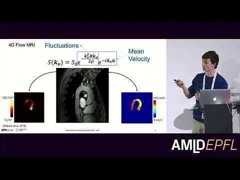 Generation of a Large Synthetic Dataset for Learning Physics-based Optimal Inference of 4D flow MRI