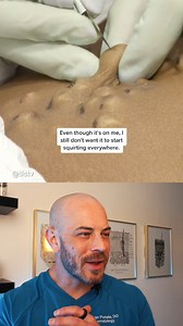 447K views · 811 reactions | Derm reacts to buttery pimple pops! #dermreacts #doctorreacts #butterypimplepop | Dr. Dustin Portela, Dermatologist | Facebook