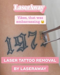Ready to ditch your unwanted ink? Laser tattoo removal by LaserAway produces dramatic results with multiple sessions and works on all skin types! | LaserAway
