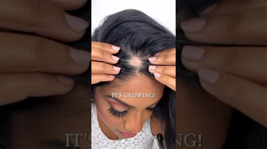 The Nostalgia of Amla Oil: A Natural Hair Remedy Brown Girls Know Well