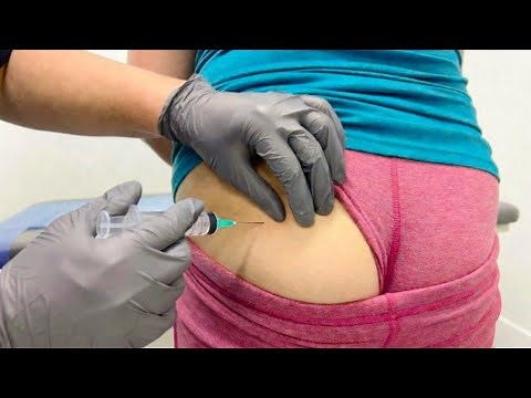 Intramuscular (IM) Injection Technique Explained | Nursing Clinical Skills & Patient Safety Guide