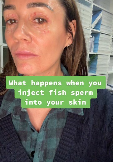 Polynucleotide Treatment for Skin Regeneration