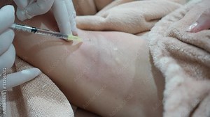 Medical specialist injecting syringe botox into armpit for reduce body odor and wrinkles