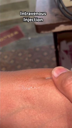 Intravenous injection 😱#doctor #viralshort #trendingshorts
