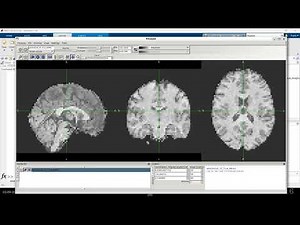 E5 | NIFTI files | MRI Images | .nii | Basics of MATLAB for MRI/fMRI