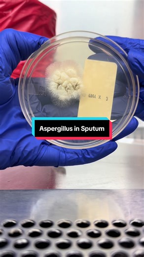 Understanding Aspergillus and Its Significance