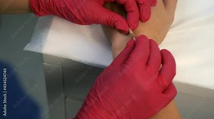 Cosmetologist is making injection using long needle on woman's hands to contouring with fillers in clinic, hands closeup. Cometic beauty procedure in cosmetology clinic. Rejuvenation of skin of hands.