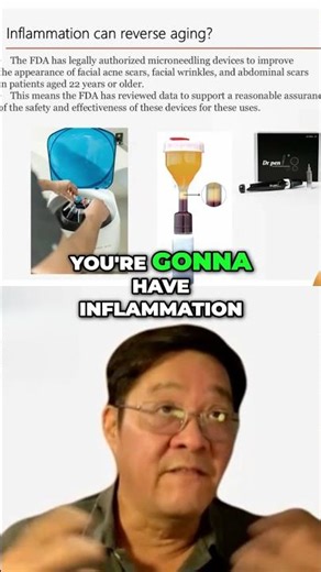 #8 Kim Kardashian's Vampire Facial Does It Really Work