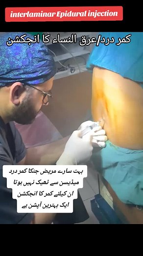 Relief for Sciatica: Interlaminar Epidural Injection Benefits