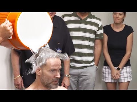 Hair Fibers vs DermMatch: Hair loss concealer live comparison.