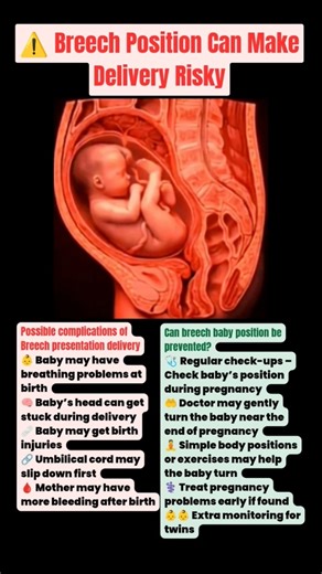 vaginal delivery | Breech Baby? 😱 What Happens During Delivery! #shorts