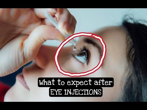What to expect after EYE INJECTION? #eyeinjection #maculardegeneration