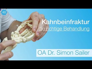 #48 Pseudarthrose beim Kahnbein - was tun wenn der Bruch nicht heilt?