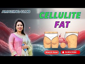 “Cellulite Fat Explained | Causes & Best Ways to Reduce It Naturally!”