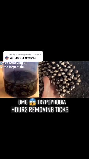 Removing Ticks from Jar Comparison and Tips for Trypophobia Relief