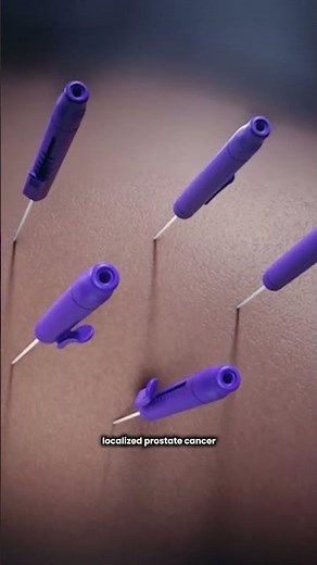 Inside the OR: The Nano Knife Treatment for Prostate Cancer | Georgia Urology