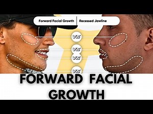 How To Promote Forward Facial Growth | Looksmaxxing Easy Guide
